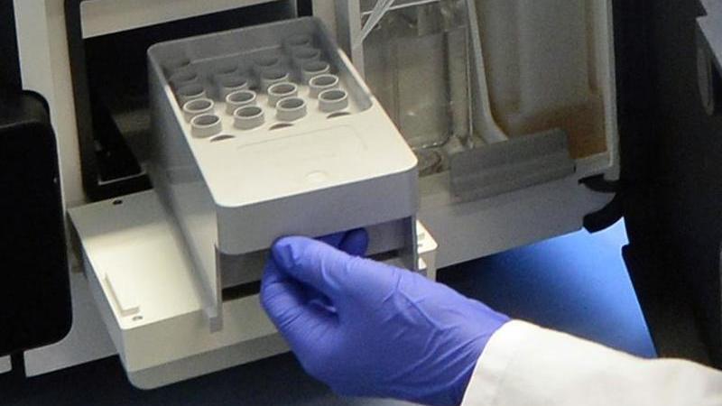 Krebsforschung: 50 Millionen Euro für fünf Zentren Krebsforschung
