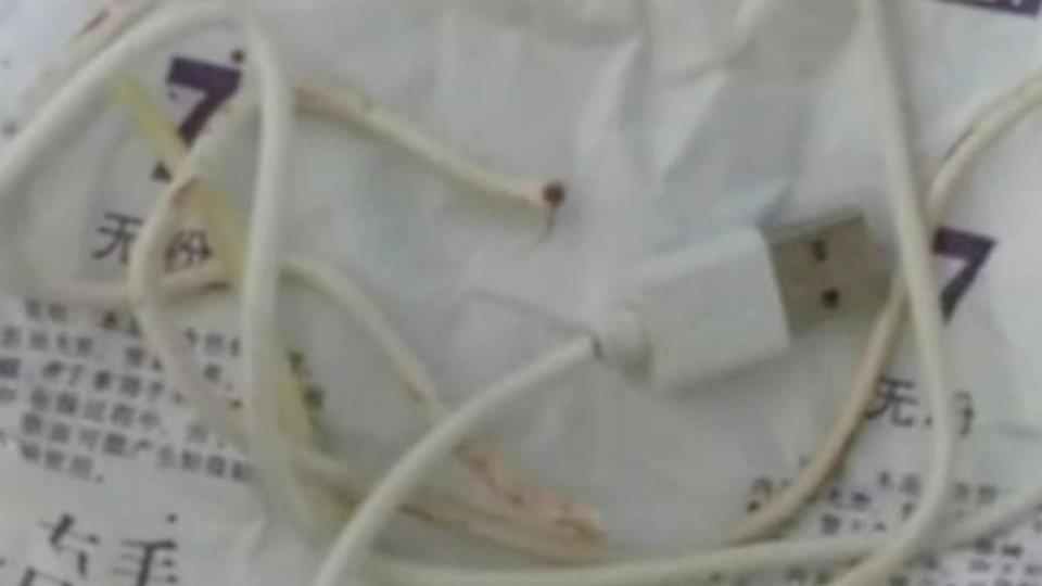 Aus Neugierde: Junge (13) schiebt sich USB-Kabel in seinen Penis – Klinik Ladekabel nach der Operation.