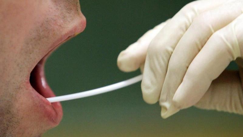 15 Jahre nach dem Tod einer Münsteranerin wurde ihr mutmaßlicher Mörder gefasst Speichelprobe wird mit Wattestäbchen entnommen