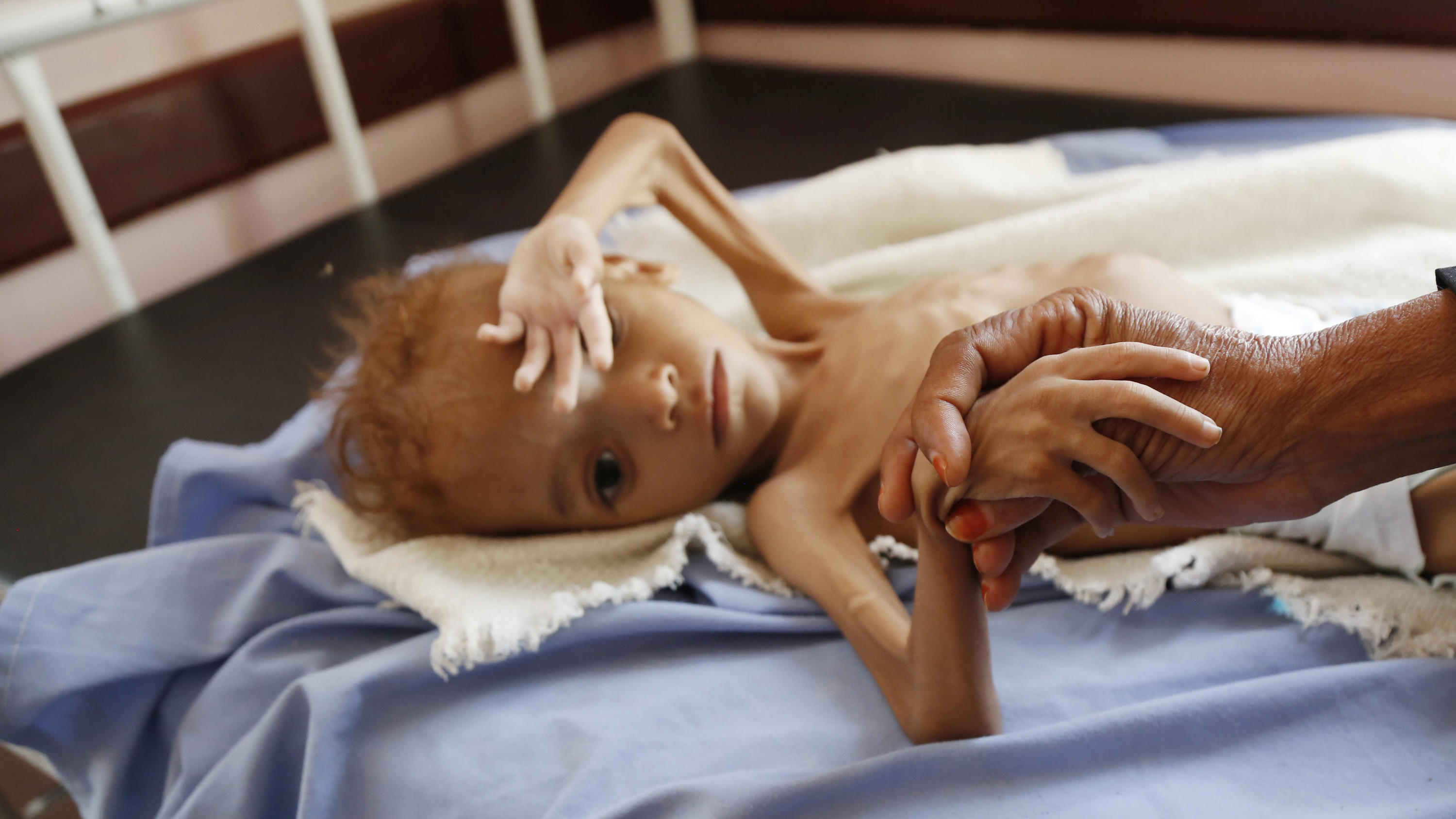 Welthunger-Index 2018: Der Kampf gegen den Hunger bleibt aussichtlos Welthunger-Index 2018: Im Kampf gegen den Hunger gibt es nach kleineren Erfolgen wieder einen Rückschritt.