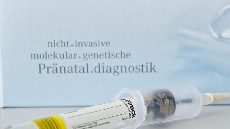 Bluttests auf Down-Syndrom auf dem Prüfstand Down-Syndrom-Bluttest