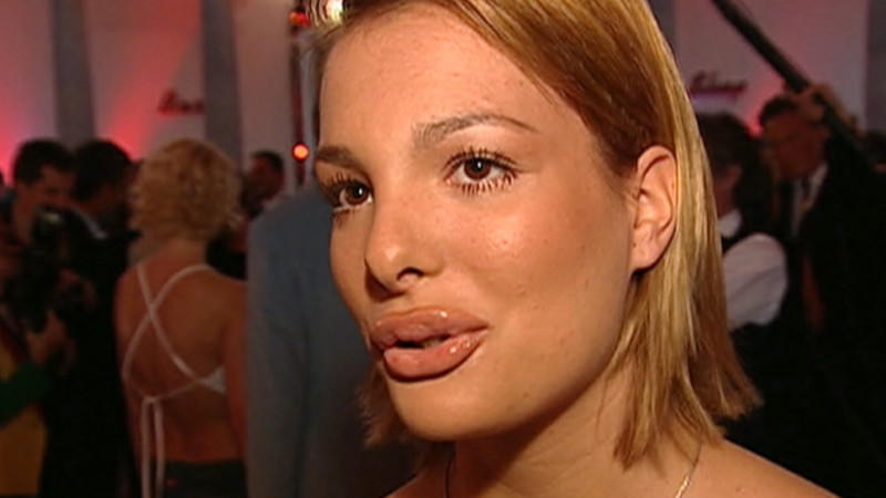 20 Jahre Exclusiv: Kuriose Antworten und spannende Geschichten Chiara Ohoven hat angeblich bei ihren Lippen nicht nachgeholfen