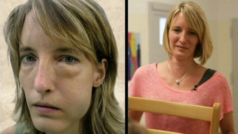 Seltene Erbkrankheit HAE: Stress bedeutet für Diana Todesgefahr Erbkrankheit HAE: Stress bedeutet für Diana Todesgefahr