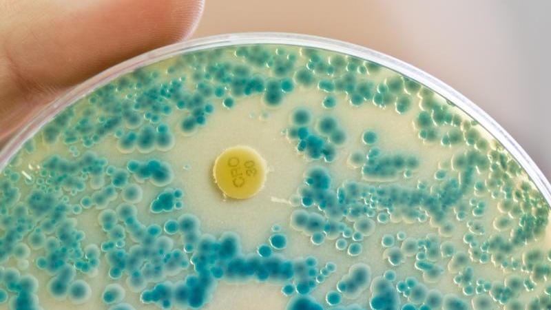 Bis zu 15.000 Tote im Jahr: Deutschland bekommt Krankenhauskeime nicht in den Griff Multiresistente Keime