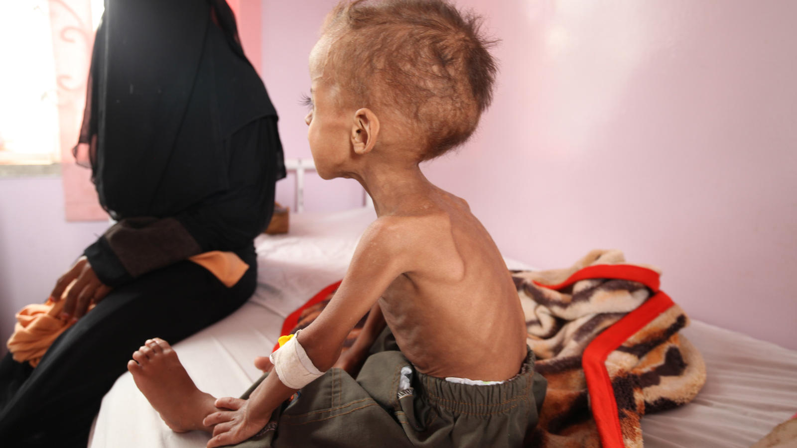 20 Millionen Menschen droht der Hungertod in Afrika HANDOUT - ARCHIV - Ein Junge wird am 29.07.2015 in einem Krankenhaus in Sanaa (Jemen) behandelt. Wegen Mangelernährung droht knapp 1,4 Millionen Kindern in den Ländern Nigeria, Somalia, Südsudan und Jemen nach Unicef-Angaben der Hungertod. (zu dpa «U