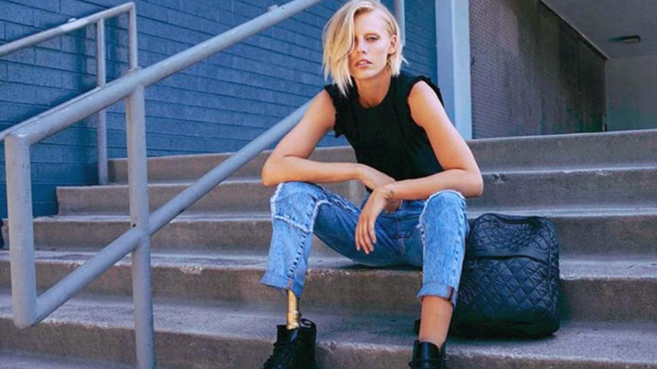 Lauren Wasser erleidet toxisches Schocksyndrom: Model verliert wegen Tampon beide Beine Lauren Wasser