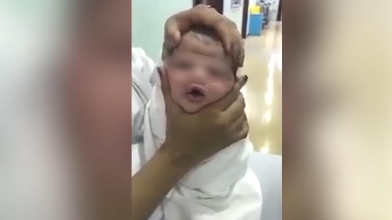 Krankenschwestern quetschen Baby den Kopf Krankenschwestern quetschen Baby den Kopf