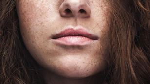 6 Tipps gegen spröde Lippen 6 Tipps gegen spröde Lippen