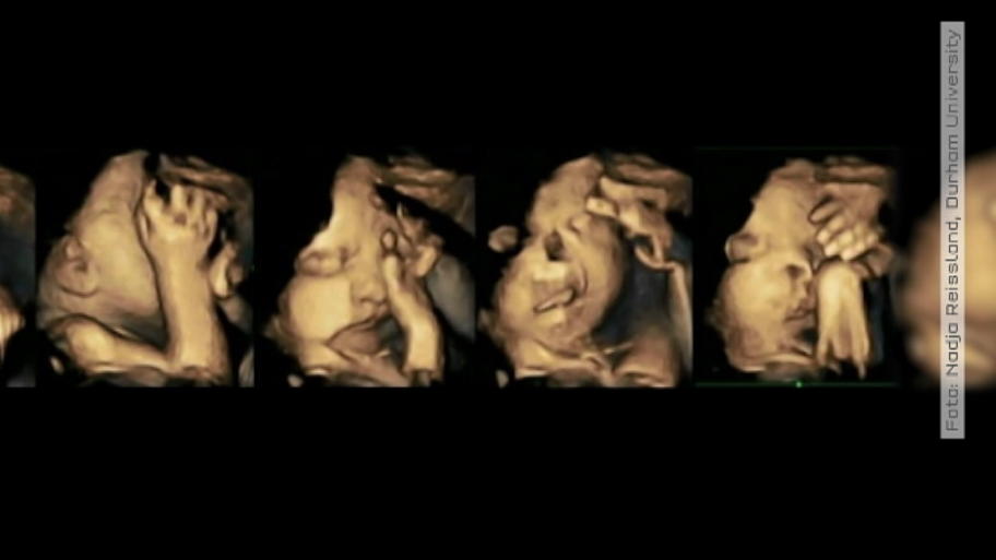 Rauchen in der Schwangerschaft: So leidet der Fötus Rauchen in der Schwangerschaft: So leidet der Fötus