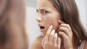 7 Ursachen für unreine Haut ab 30 7 Ursachen für unreine Haut ab 30