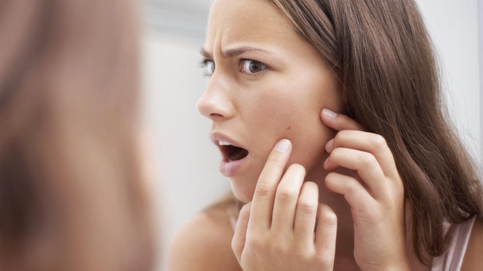 7 Ursachen für unreine Haut ab 30 7 Ursachen für unreine Haut ab 30