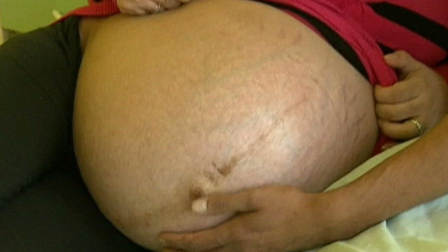 In diesem Bauch wachsen fünf Babys In diesem Bauch wachsen fünf Babys