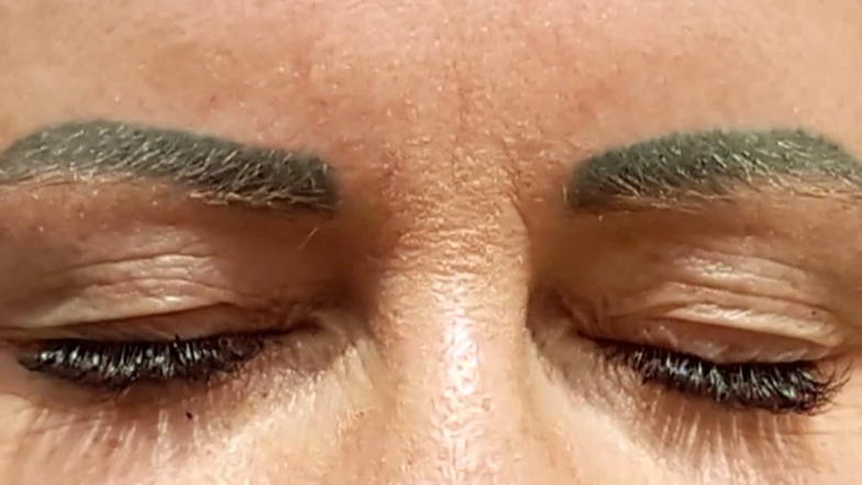 Microblading: Wenn der Traum von perfekten Brauen misslingt Microblading: Wenn der Traum von perfekten Brauen misslingt