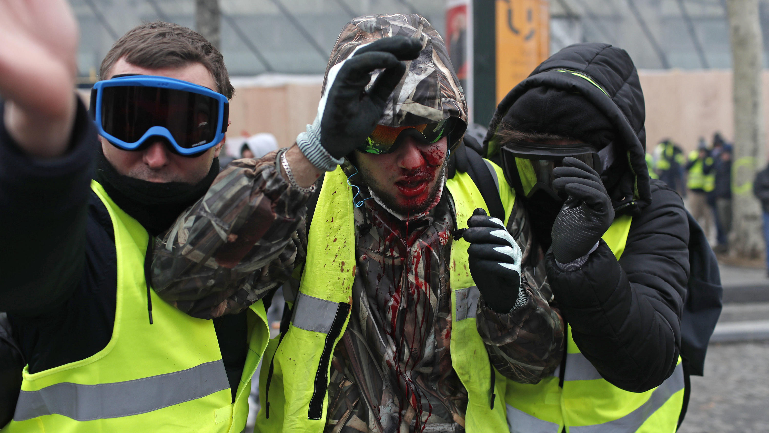 08.12.2018, Frankreich, Paris: Ein Demonstrator der «Gilets Jaunes» (Gelbwesten) ist mit Blut bedeckt, nachdem er bei einem Protest verletzt wurde. Bei Protesten der «Gelbwesten» sind am Samstagvormittag in Paris mehrere Hundert Menschen festgenommen