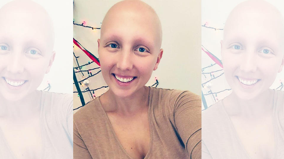 #baldandbadchallenge: Frauen posten stolz Bilder ihrer #baldandbadchallenge: Frauen posten stolz Bilder ihrer