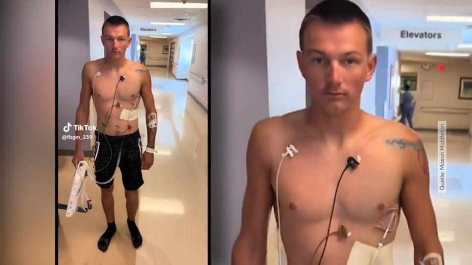 Wie gefährlich Vapen ist: Mason hat sich ein Loch in die Lunge geraucht
